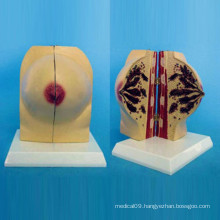 Normal Female Breast Anatomy Model for Medical Teaching (R150106)